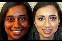 Best Gluta Drip in Dubai .